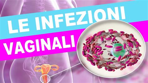 Secrezioni Vaginali Come Riconoscerle E Come Curarle In Modo Naturale