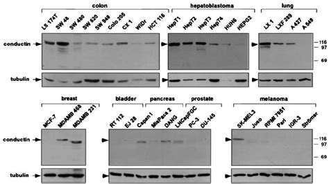 Western Blot Analysis Of Conductin In Human Tumor Cell Lines Western