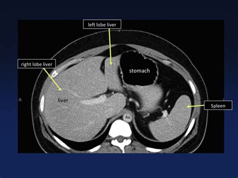 Cross Sectional Anatomy Of The Body Mdct Atlas Ct Scanning