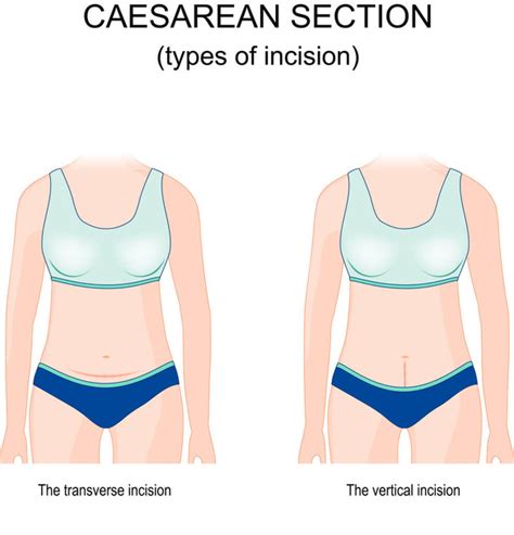 Transverse Section Free Stock Vectors