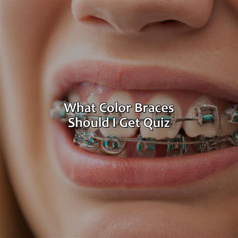 What Color Braces Should I Get Quiz Branding Mates