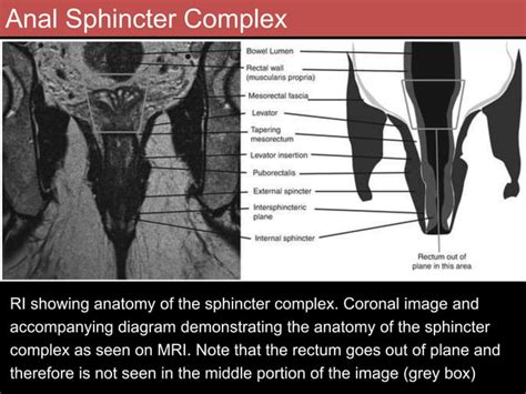 Role Of Mri In Rectal Carcinoma PPT