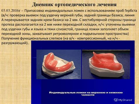 Ортопедическая стоматология. История болезни - презентация онлайн