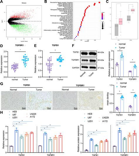 The Expression Of Tgfb And Tgfbr In Glioma Tissues And Cells A