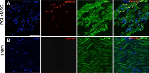 Representative Micrographs Of Bdnf Immunolabeling On Sciatic Nerve At