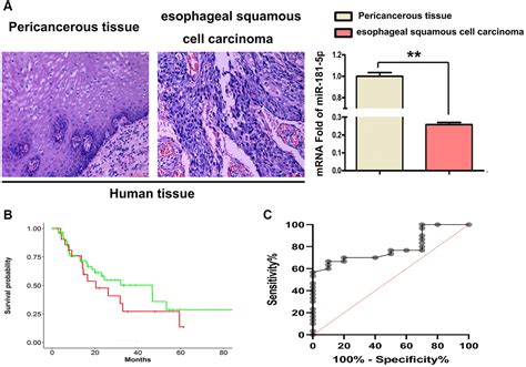 Microrna 181a 5p Prevents The Progression Of Esophageal Squamous Cell