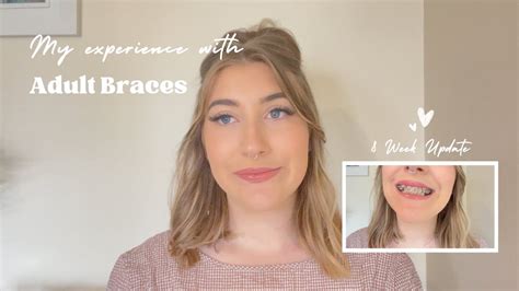 Adult Braces 8 Week Update Youtube