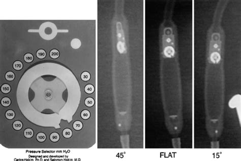 Fluoroscopy Of Programmable Cerebrospinal Fluid Shunt Valve Settings In