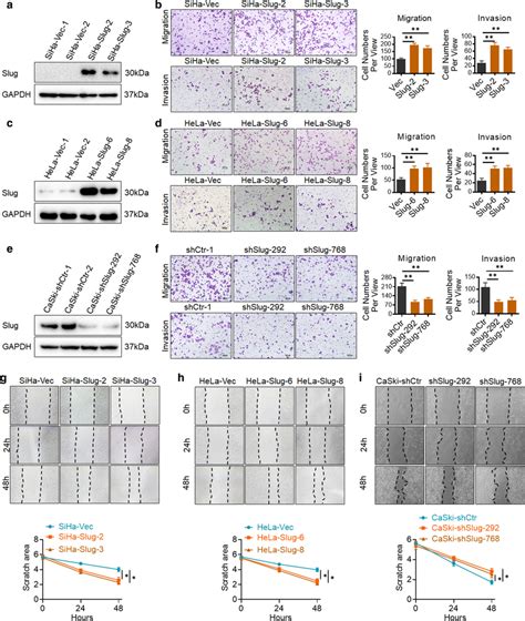 Slug Promotes Cell Migration And Invasion Of Cervical Cancer Cells In Download Scientific