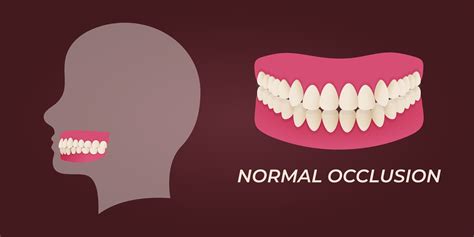 7 Types of Malocclusion | AllSmiles Dental Care