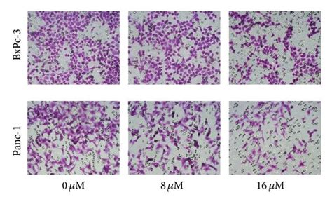 α Mangostin Inhibits The Migration And Invasion Of Pancreatic Cancer Download Scientific