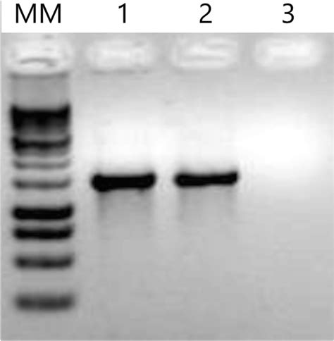 Pcr Amplification Of The 16s Rrna Gene The Dna Was Extracted From T Download Scientific