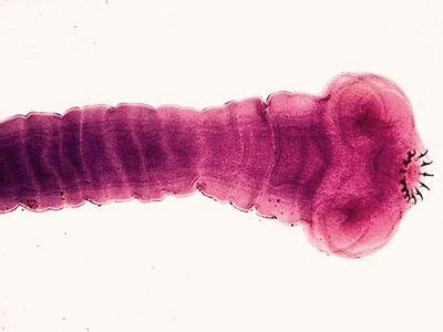 Tapeworm Under A Microscope