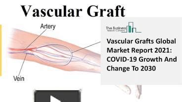 Ppt Vascular Grafts Market Impact Of Covid Industry Overview And