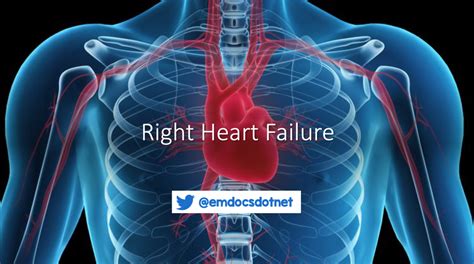 Emergency Medicine Educationright Heart Failure In The Ed