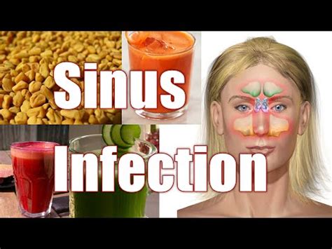 Will Antihistamines Help With Sinus Pressure