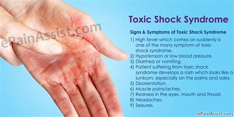 Shock Signs Symptoms And Complications