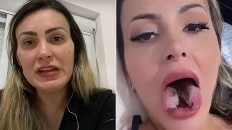 Saiba quanto Andressa Urach gastou para realizar procedimento estético