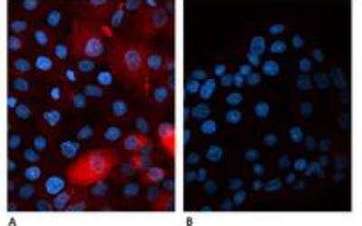 Beta 2 Microglobulin Antibody B2M 01 BSA Free NB500 317 Bio Techne