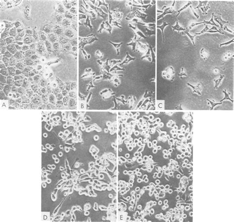 Morphologies Of Infected A431 Cell Clones Phase Contrast Micrographs