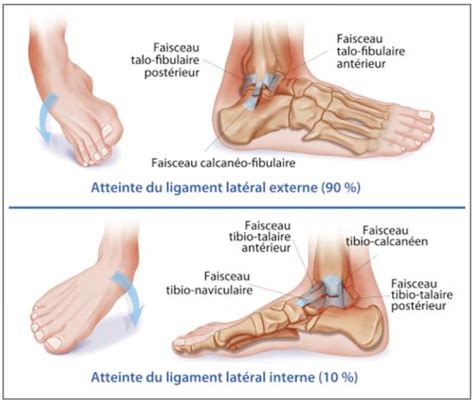 Entorse La Cheville Conseils D Experts En Physioth Rapie Kinatex