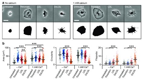 Oxidized Low Density Lipoprotein OxLDL Influences Platelet Shape A