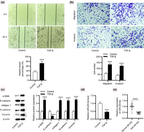 miR 223 3p alleviates TGF β induced epithelial mesenchymal transition