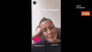 Kasia Smutniak Crea Filtro Instagram Che Simula Vitiligine Per