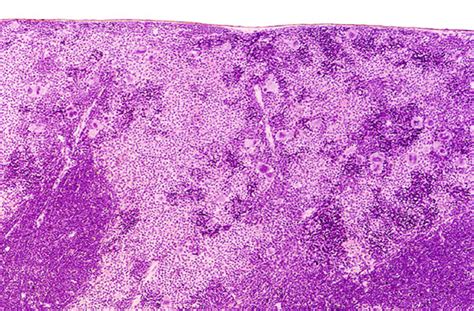 Mast Cell Tumor | National Institute of Environmental Health Sciences