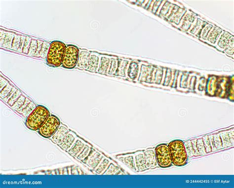 Nodularia Sp Algues Toxiques Sous Vue Microscopique X Image Stock