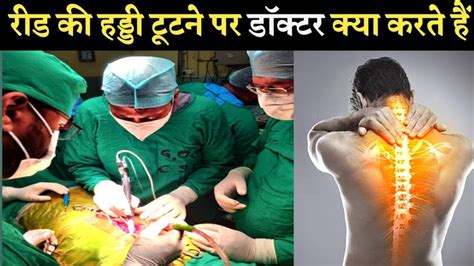 डकटर कस करत ह रड क हडड क ऑपरशन spine surgery operation