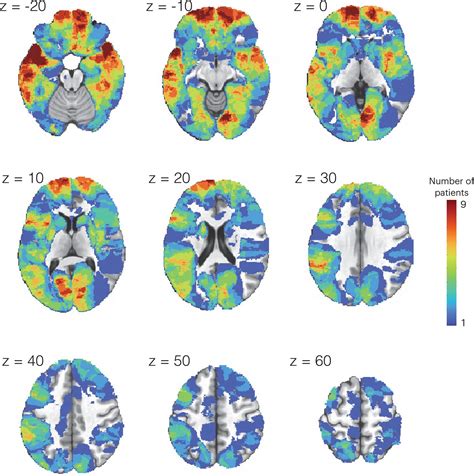 Figures And Data In Neuropsychological Evidence Of Multi Domain Network