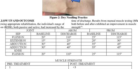 Figure From Efficacy Of Dry Needling In Post Total Knee Replacement