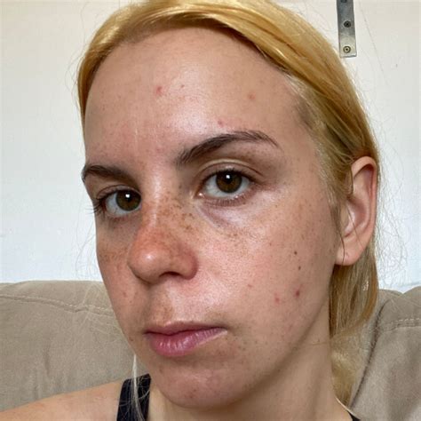 Understanding Why Your Skin Looks Dull And How To Brighten It