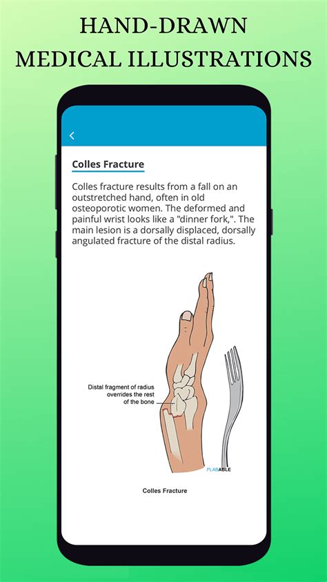 Plabable for PLAB APK for Android - Download