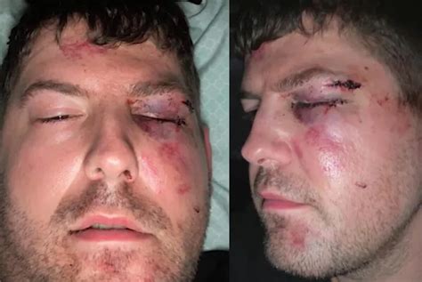 Coppia Gay Brutalmente Picchiata In Un Parcheggio Camminavano Abbracciati Gay It