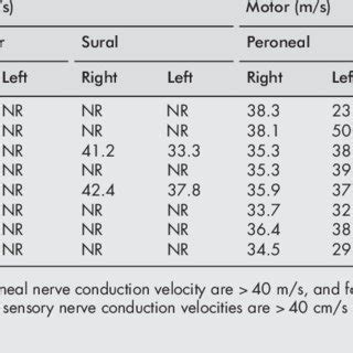 Results of patients' nerve conduction velocity tests | Download Table