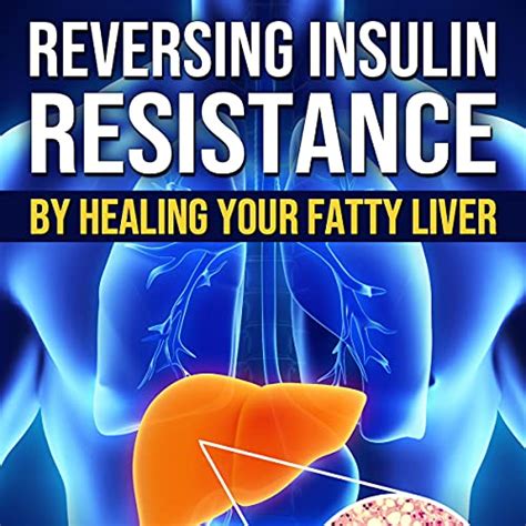 Reversing Insulin Resistance By Curtis Slade Audiobook Audible