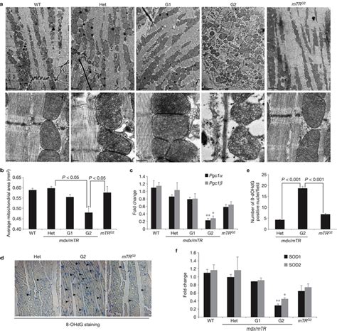 Telomere Dysfunction Is Associated With Mitochondrial Abnormalities And