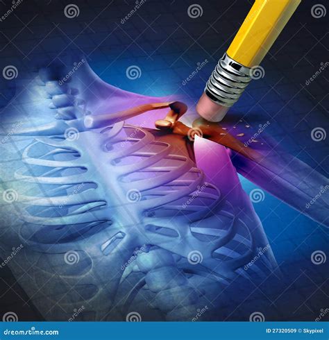 Shoulder Pain Relief stock illustration. Illustration of problem - 27320509