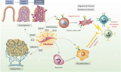 Figure From Role Of Cancer Associated Fibroblast In Gastric Cancer