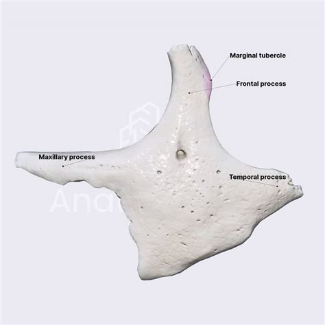 Zygomatic bone (overview and processes) | Skull | Head and Neck ...