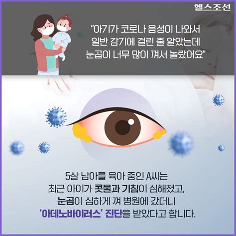 카드뉴스 눈곱 감기 증상 보이는 우리 아이 ‘아데노바이러스 주의하세요 당신의 건강가이드 헬스조선