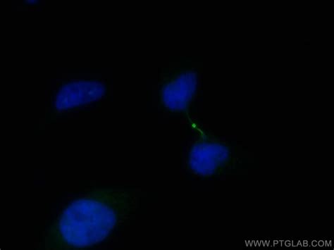 PRC1 Monoclonal Antibody 1E1D5 CoraLite488 Proteintech 100 μL