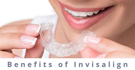 What Are The Top Benefits Of Invisalign