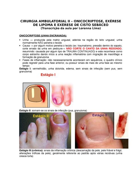 Cirurgia Ambulatorial Ii Cirurgia Ambulatorial Ii Onicocriptose