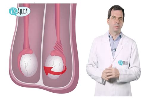 O Que Pode Ser Dores No Testículo - Sintomas de dor no testículo.Veja o vídeo com a explicação do ...