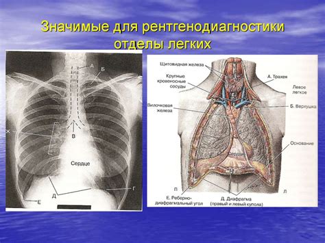 Легкие В Грудной Клетке Фото Mixyfotos ru