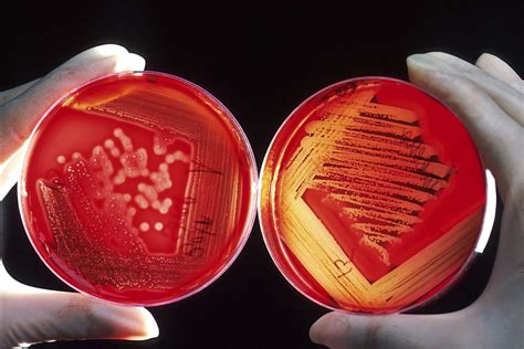 Bacterial Streak Plate