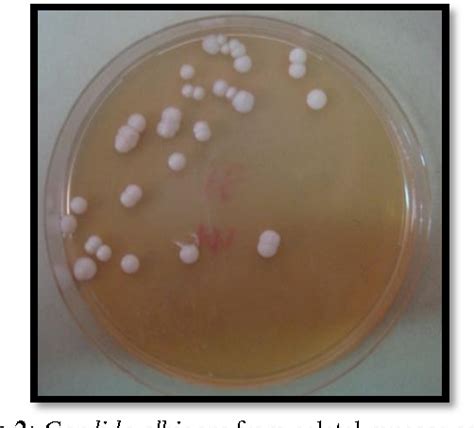 Figure 2 From Assessment Of Oral Sample Collection Technique For The Isolation Of Candida